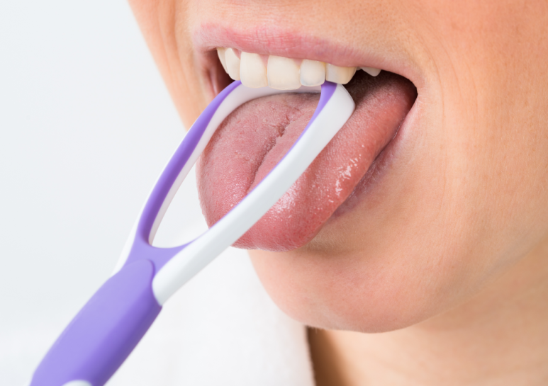 5 Causes of Tongue Coating: Cases That Can’t Be Solved by Brushing Alone image 7
