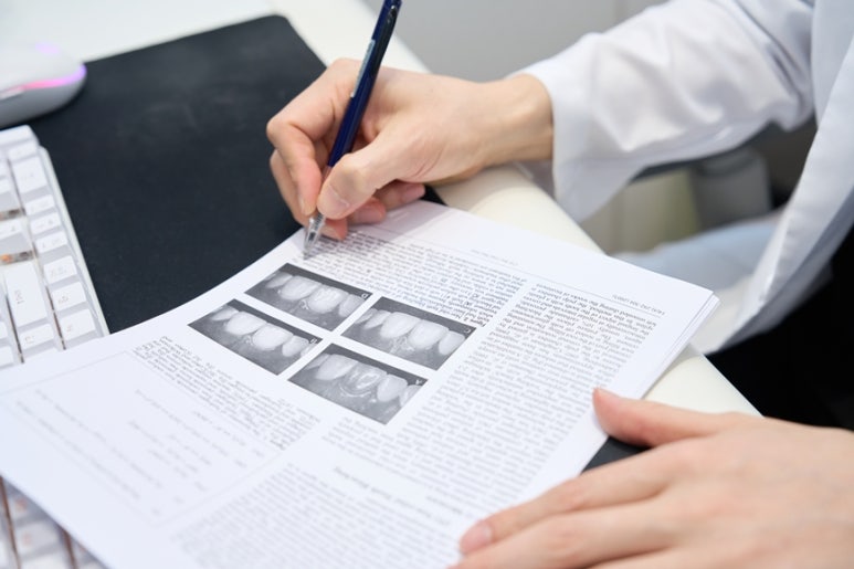 라미네이트 후기, 하얗다고 다 예쁜 건 아닙니다 관련 이미지 11