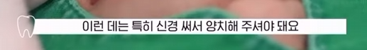 잇몸 부었을 때, 절대로 방치하면 안되는 증상 3가지 관련 이미지 3