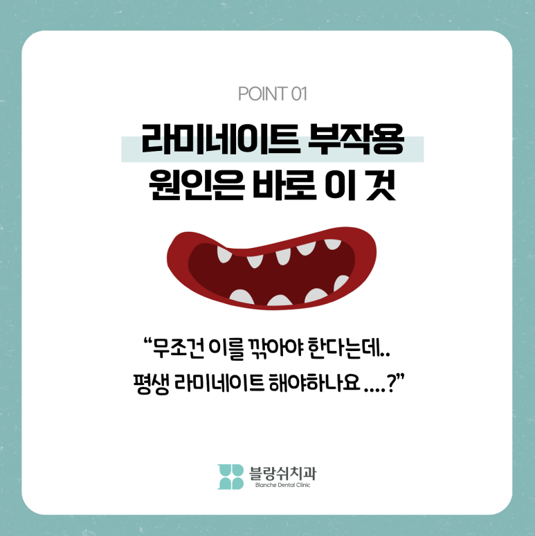 라미네이트 부작용 치아 삭제 전 반드시 알아야 할 것 관련 이미지 2