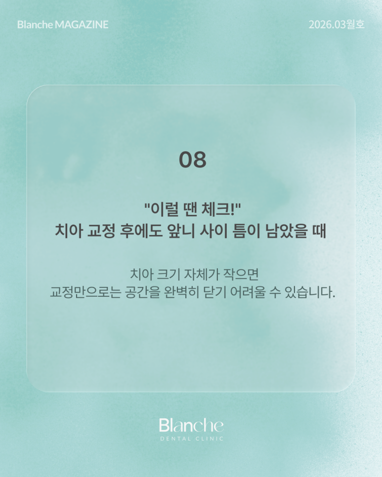 유독 작은 옆니(왜소치), 깎지 않고 예뻐질 수 있을까? 관련 이미지 14