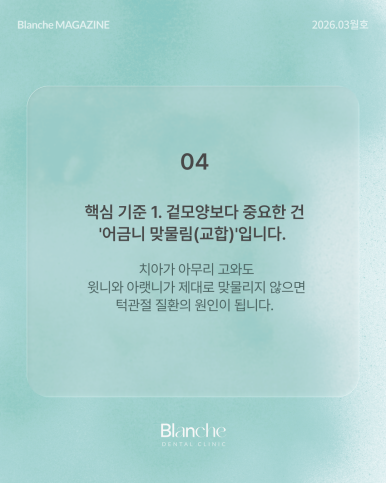 치아 교정 전 관련 이미지 5