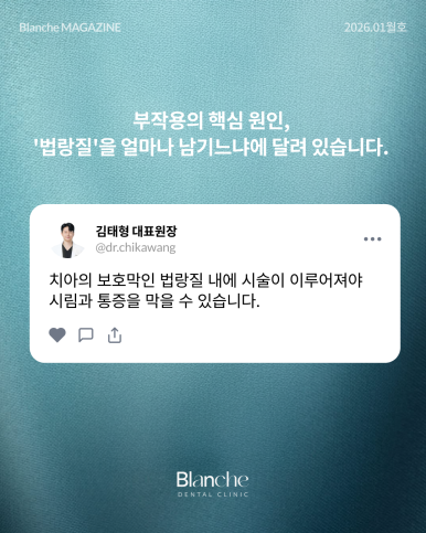 무삭제 라미네이트는 "부작용"이 없다? 관련 이미지 5