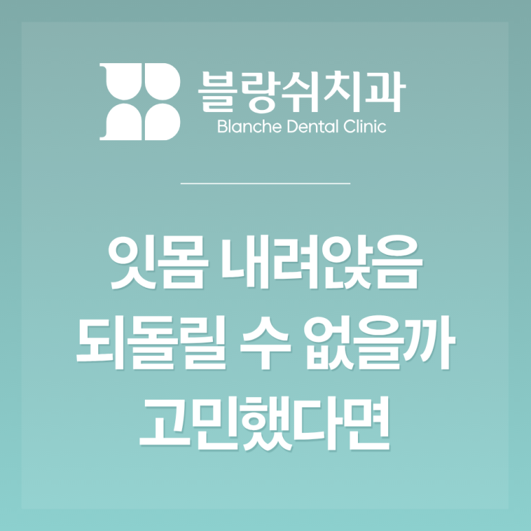신논현역 잇몸 내려앉음 되돌릴 수 없다는 말에 포기하셨다면 관련 이미지 2
