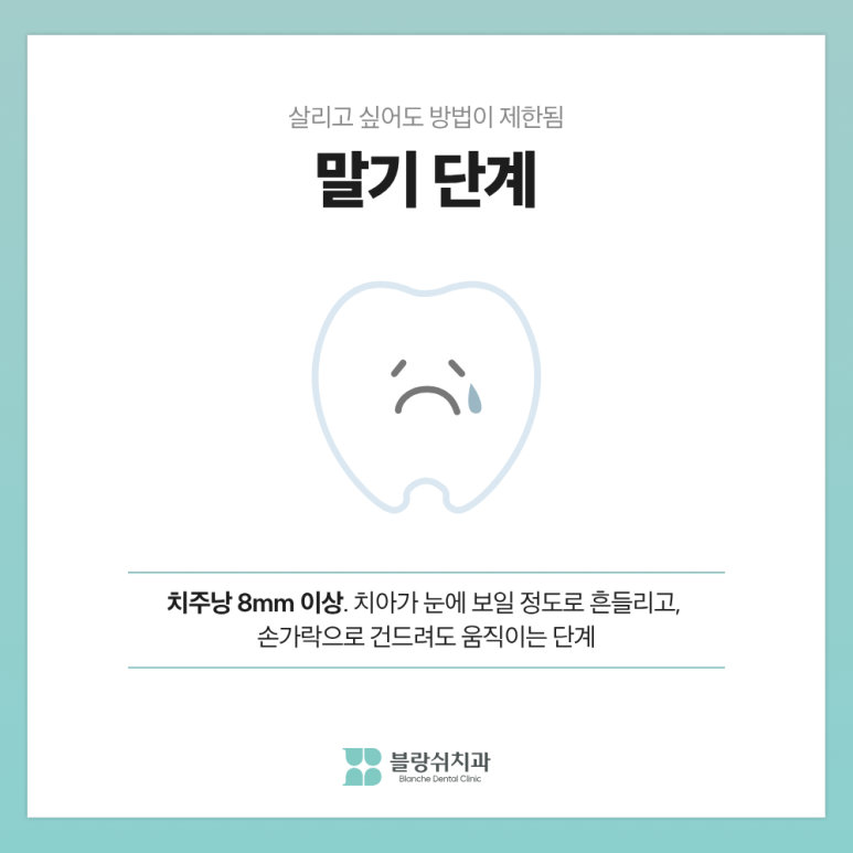 풍치 치료 초기&middot;중기&middot;말기, 단계별 치료비가 10배 차이 나는 이유 관련 이미지 9