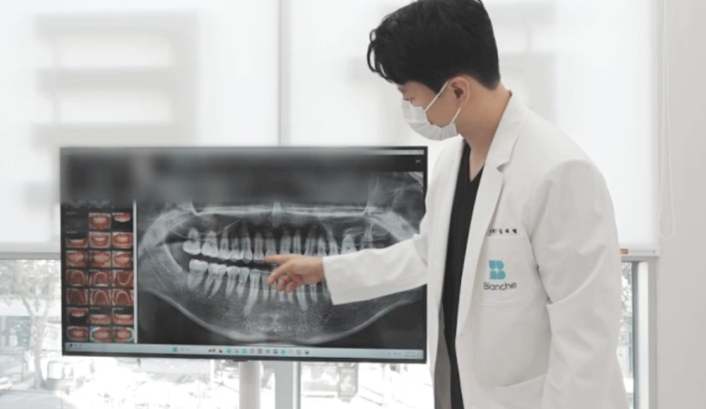 만성 치주염 증상 잇몸에서 피나고 이가 흔들린다면 먼저 확인할 3가지 관련 이미지 5