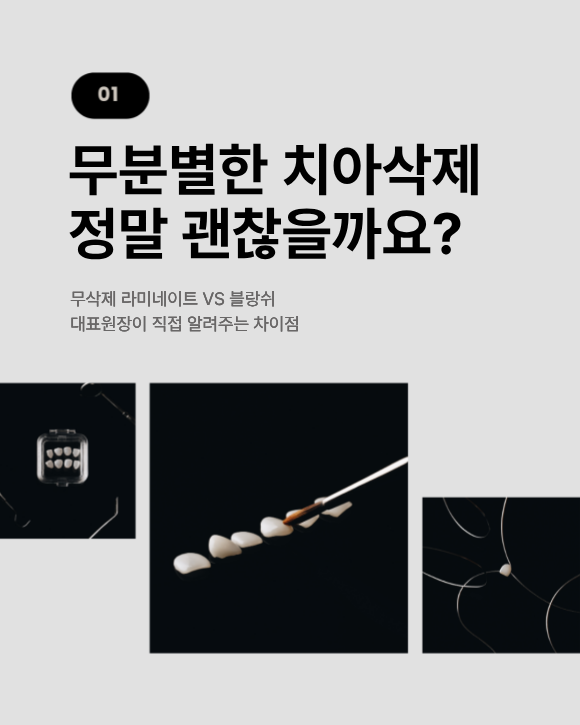 무삭제 라미네이트 vs 블랑쉬, 대표원장이 직접 알려주는 차이점 관련 이미지 4