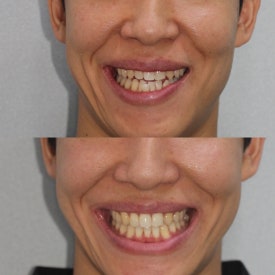 반포교정치과 고르는 3가지 기준,가격 투명 공개 관련 이미지 9