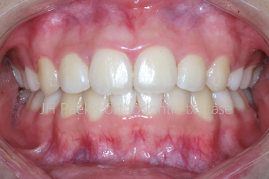 실력 있는 교정치과를 찾는 3가지 방법 관련 이미지 6