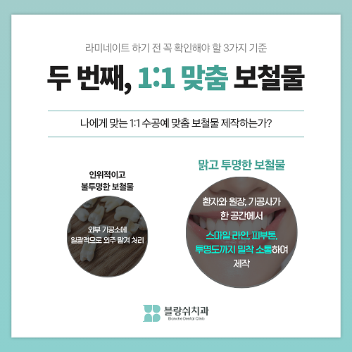 내근처치과 라미네이트 잘하는곳 찾는 기준 관련 이미지 4