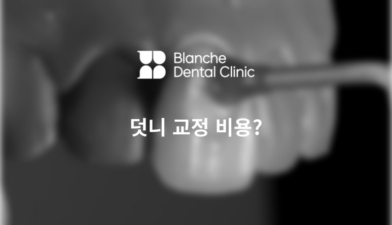덧니 교정 비용? 관련 이미지 1