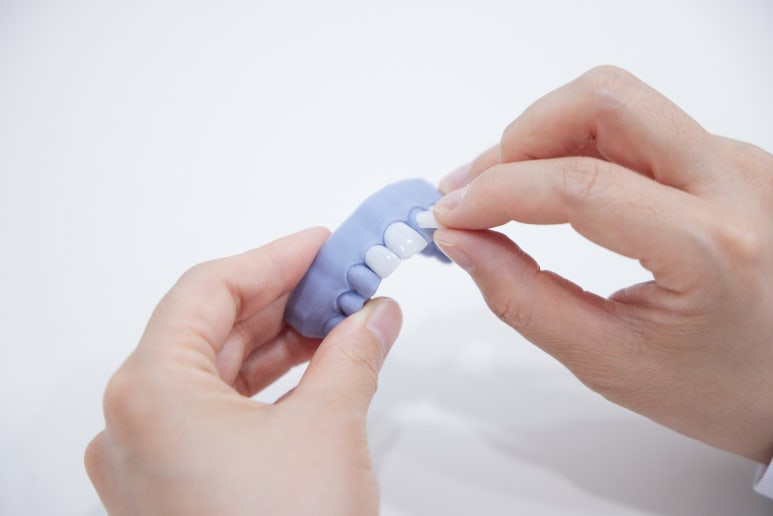 라미네이트부작용을 막는 3가지 비밀 - 대표원장 작성 관련 이미지 4