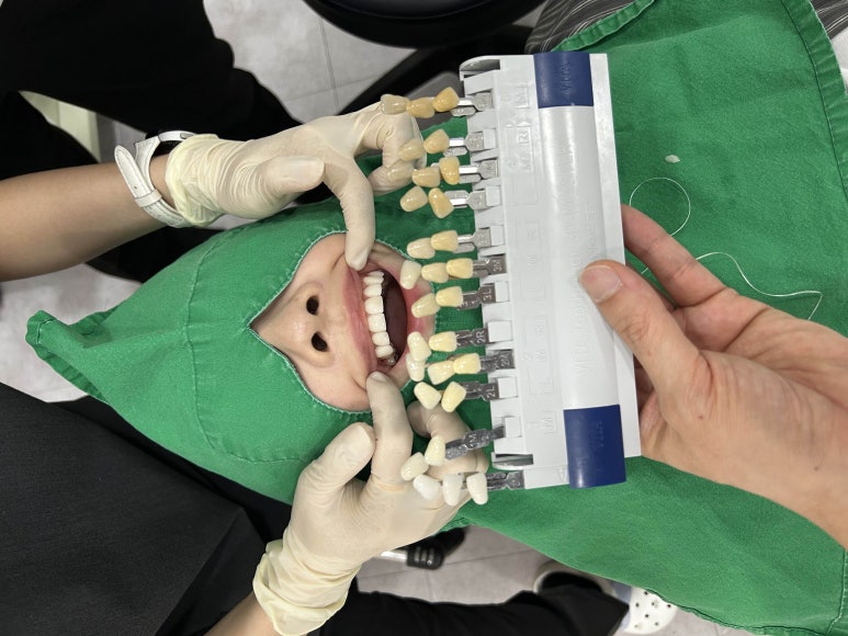 라미네이트치아삭제부작용, 있는 그대로 말씀드립니다 관련 이미지 6