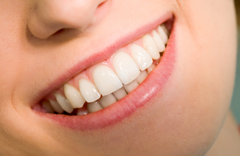 치아이식술 성공률 높이는 핵심 조건 3가지, 임플란트 전에 꼭 읽어보세요 관련 이미지 8