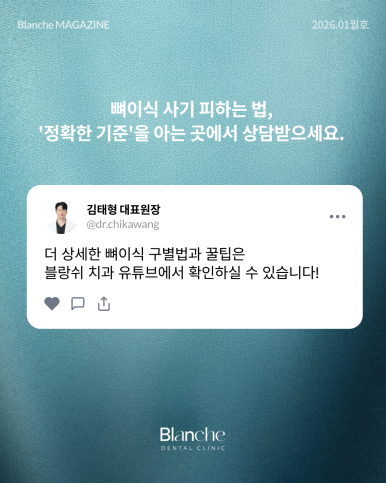 "임플란트 뼈이식, 무조건 해야 하나요?" 과잉진료 피하는 법 관련 이미지 16