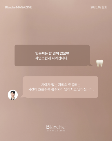 어금니 뺀 자리, 당장 안 아픈데 꼭 임플란트 해야 할까? 관련 이미지 10