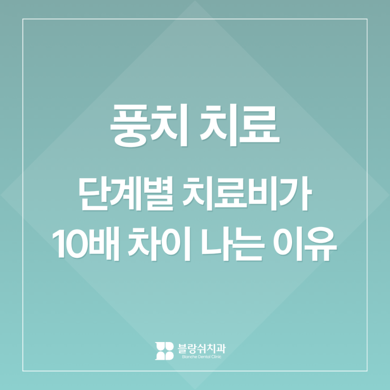 풍치 치료 초기&middot;중기&middot;말기, 단계별 치료비가 10배 차이 나는 이유 관련 이미지 1