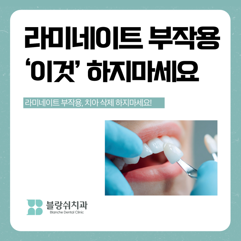라미네이트 부작용 치아 삭제 전 반드시 알아야 할 것 관련 이미지 1