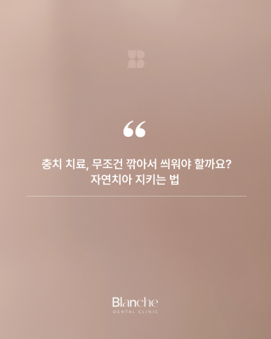 충치 치료, 무조건 깎아서 씌워야 할까? 관련 이미지 1