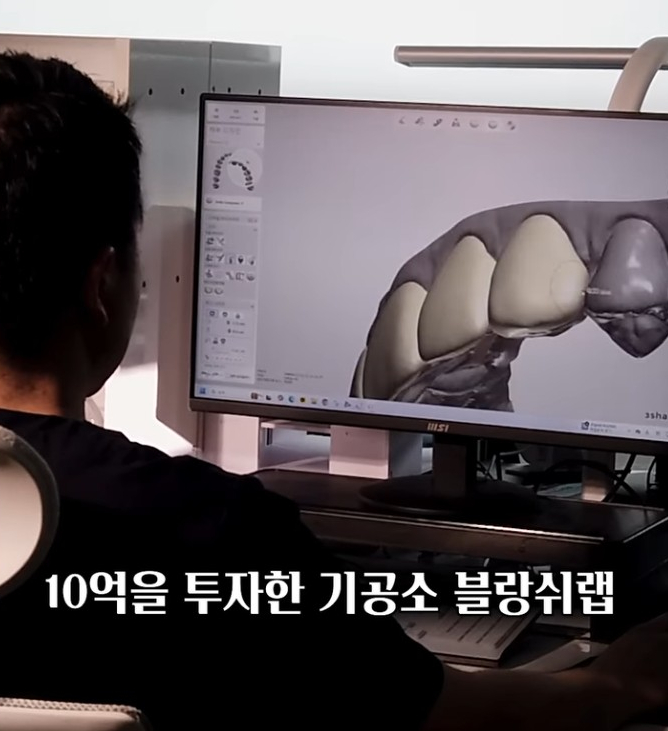 치아 무삭제 라미네이트, 관련 이미지 7