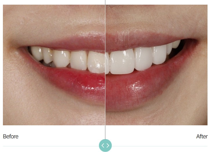 No-Prep Laminate Cost: What Matters More Than the Number image 4