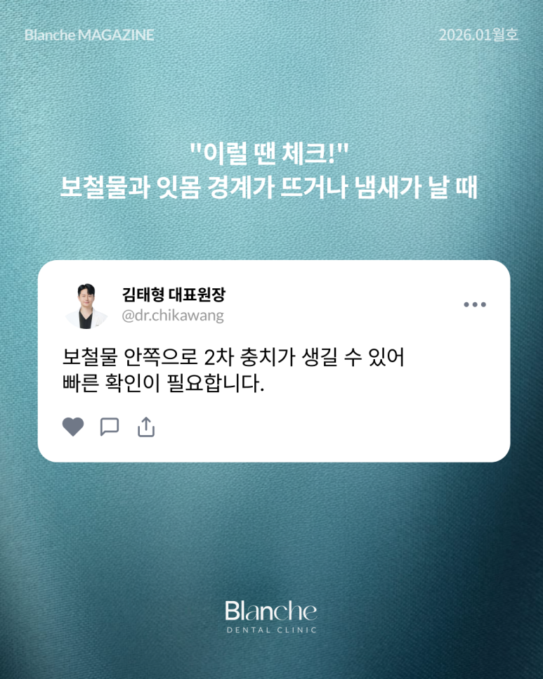 무삭제 라미네이트는 "부작용"이 없다? 관련 이미지 10