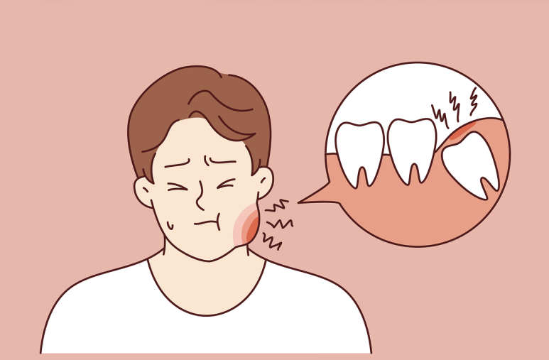 충치치료 비용 건강보험 적용 기준은 관련 이미지 2