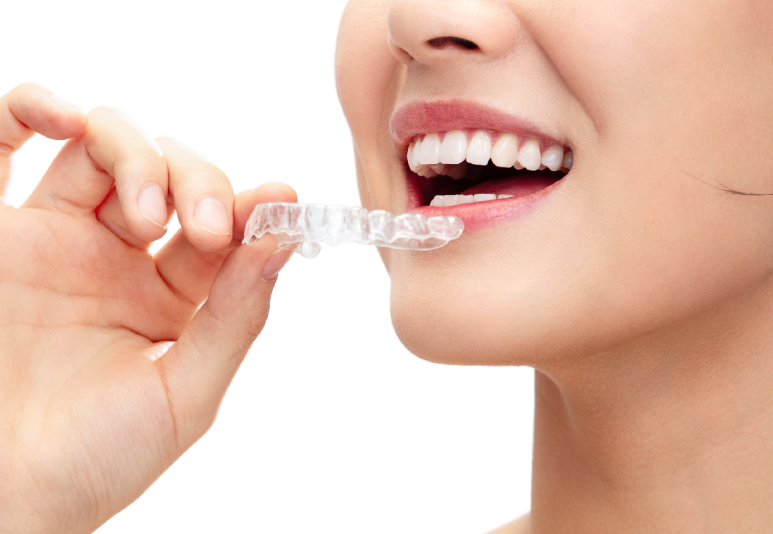 잠원역 인비절라인 후기 티 나는지 다들 가장 많이 묻는 질문 3가지 관련 이미지 3