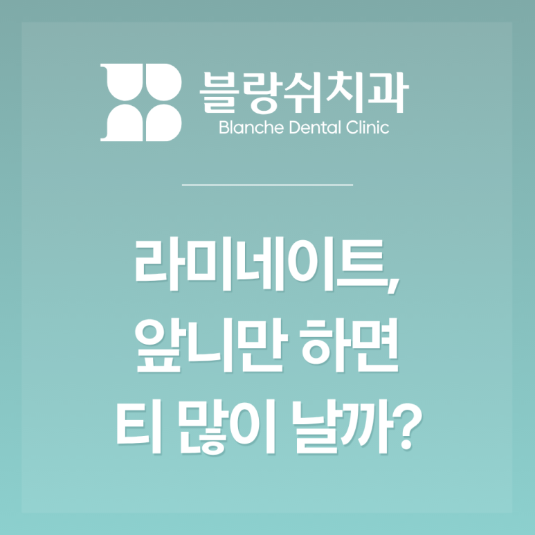 블랑쉬 앞니 라미네이트 가격? 4개 6개 8개 처음이라면 꼭 확인해야하는 3가지 관련 이미지 2