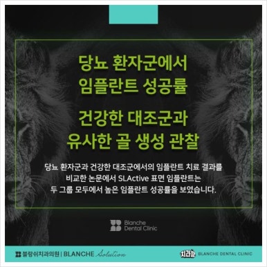 블랑쉬치과에서 프리미엄 임플란트 진료를 하는 이유를 말씀드립니다 관련 이미지 6