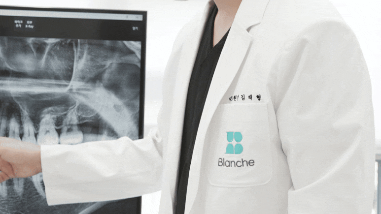 앞니벌어짐치료, 라미네이트 10년차 의사의 조언 관련 이미지 6