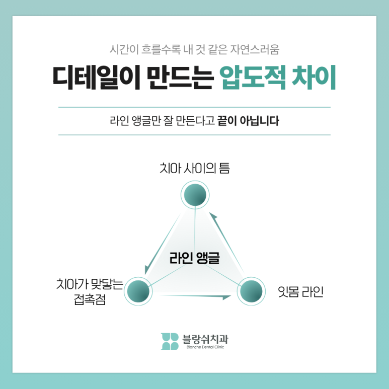 연예인 라미네이트 티 안나고 자연스러운 이유 관련 이미지 9