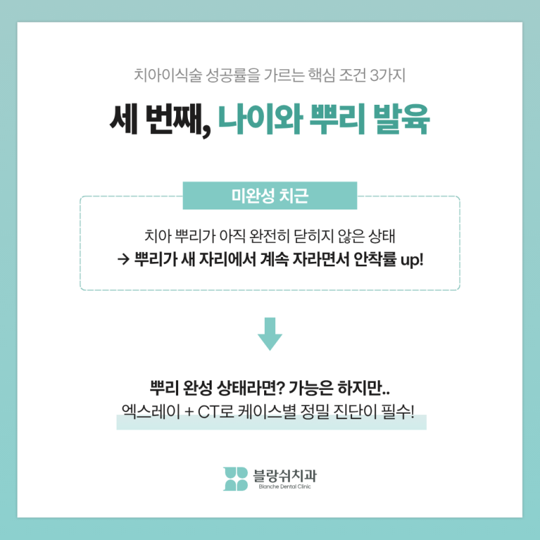 치아이식술 성공률 높이는 핵심 조건 3가지, 임플란트 전에 꼭 읽어보세요 관련 이미지 7