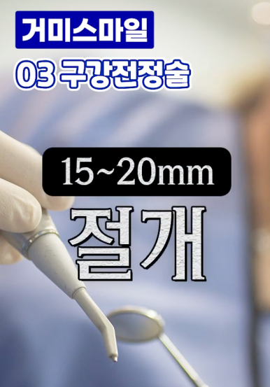 거미스마일 시술 원인 잇몸보임 구강전정술이란 관련 이미지 5