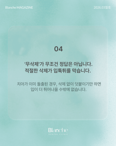 라미네이트 후 관련 이미지 6