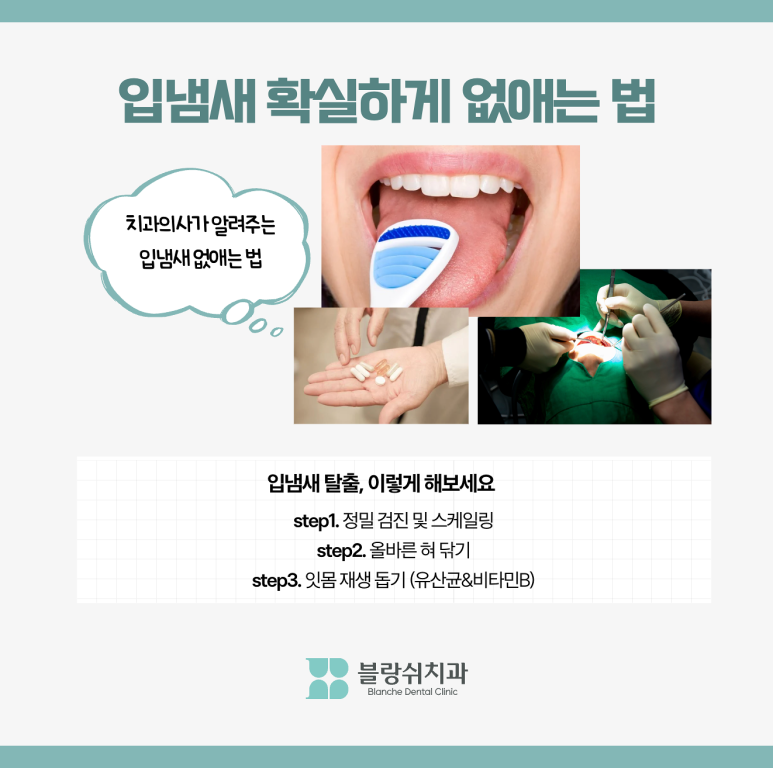 입냄새 심한 이유 구취 원인 입냄새 해결 방법 관련 이미지 4