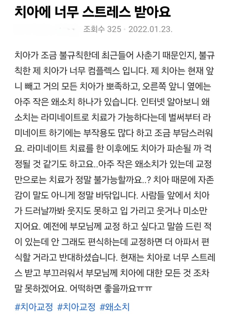 무삭제라미네이트 추천 대상, 블랑쉬는 이런 분들을 위해 만들어졌습니다. 관련 이미지 1