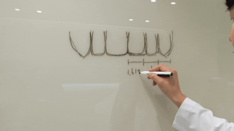 무삭제라미네이트후기, 비밀 폭로합니다 <현직의사 작성> 관련 이미지 15