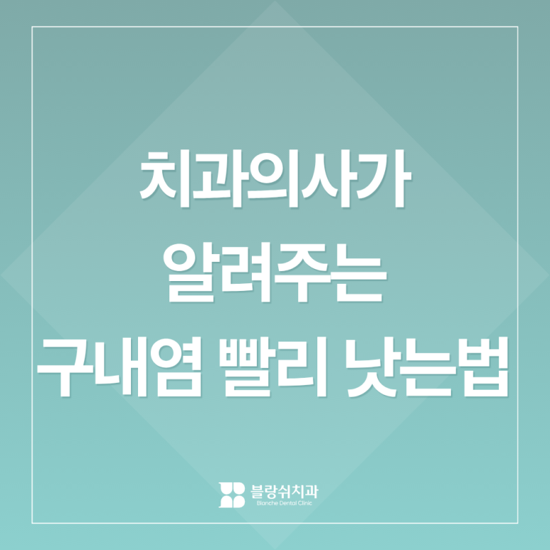 The Real Cause of Canker Sores You May Not Know: A Gangnam Dentist Explains How to Heal Canker Sores Fast image 1