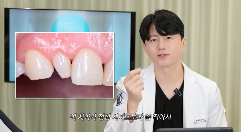 왜소치 치아교정 임플란트 고민이라면 관련 이미지 5