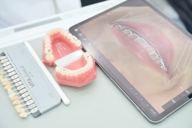 무삭제 라미네이트 부작용, 생각보다 다양했어요 관련 이미지 12