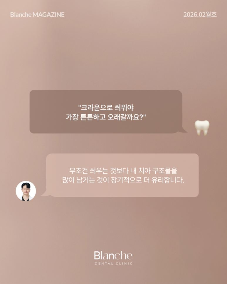 충치 치료, 무조건 깎아서 씌워야 할까? 관련 이미지 5