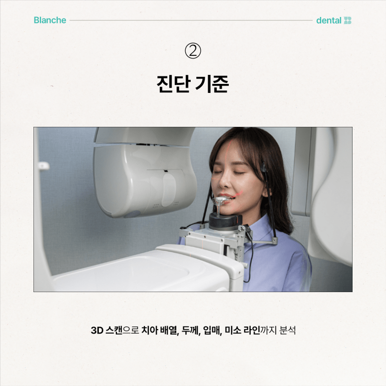 무삭제 라미네이트 부작용, 모르고 진행하면 손해보는 이유 관련 이미지 9