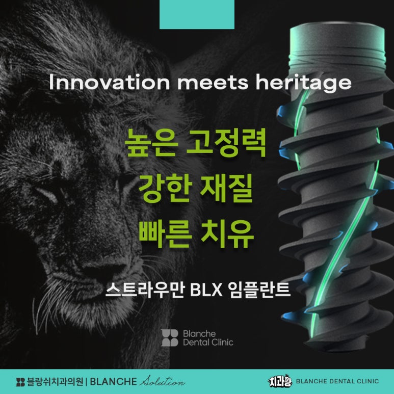 수면임플란트센터, 프리미엄 임플란트 진료는 블랑쉬치과(Blanche Dental Clinic) 관련 이미지 19