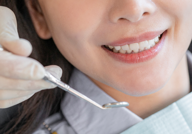 Wondering Whether You Really Need Surgery for Protruding Mouth Correction? image 4