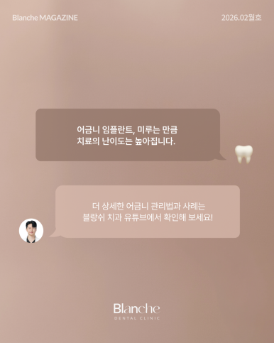 어금니 뺀 자리, 당장 안 아픈데 꼭 임플란트 해야 할까? 관련 이미지 16