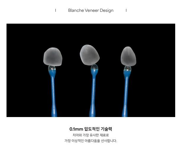 무삭제 라미네이트 vs 블랑쉬, 대표원장이 직접 알려주는 차이점 관련 이미지 9