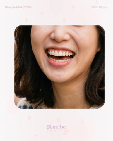 Worried About Gums Showing When You Smile? image 11