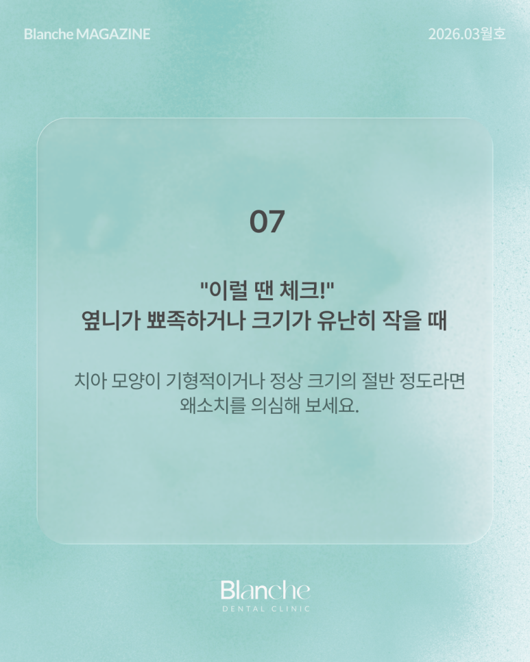 유독 작은 옆니(왜소치), 깎지 않고 예뻐질 수 있을까? 관련 이미지 13