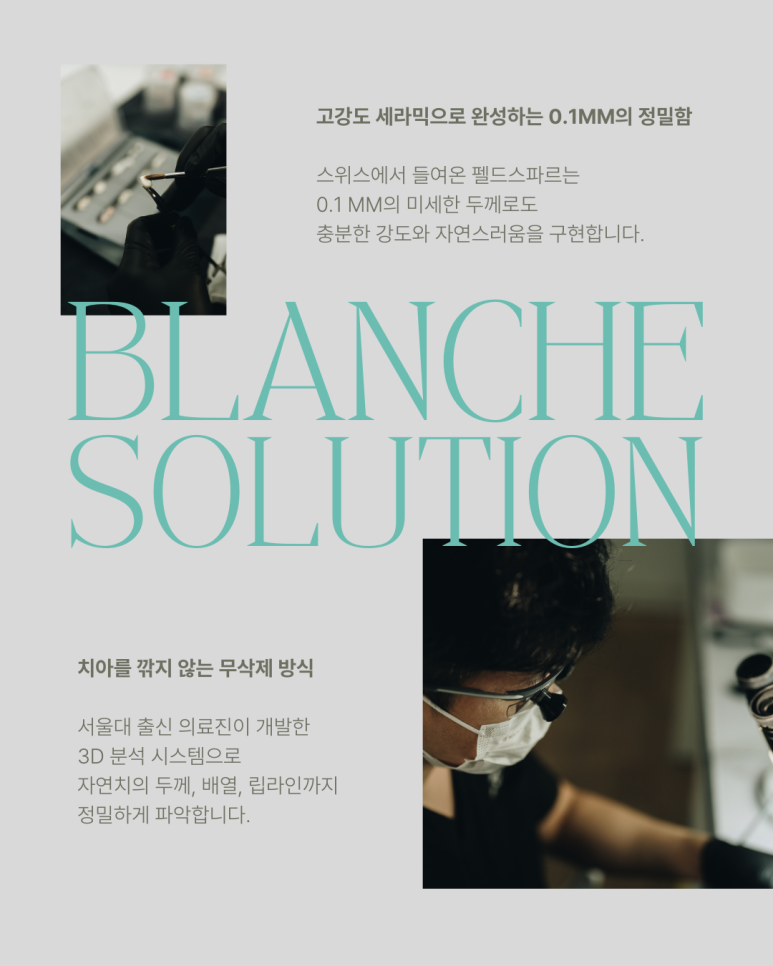 블랑쉬 라미네이트 솔루션 사례 (치아착색개선) 관련 이미지 4